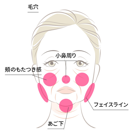 対応部位